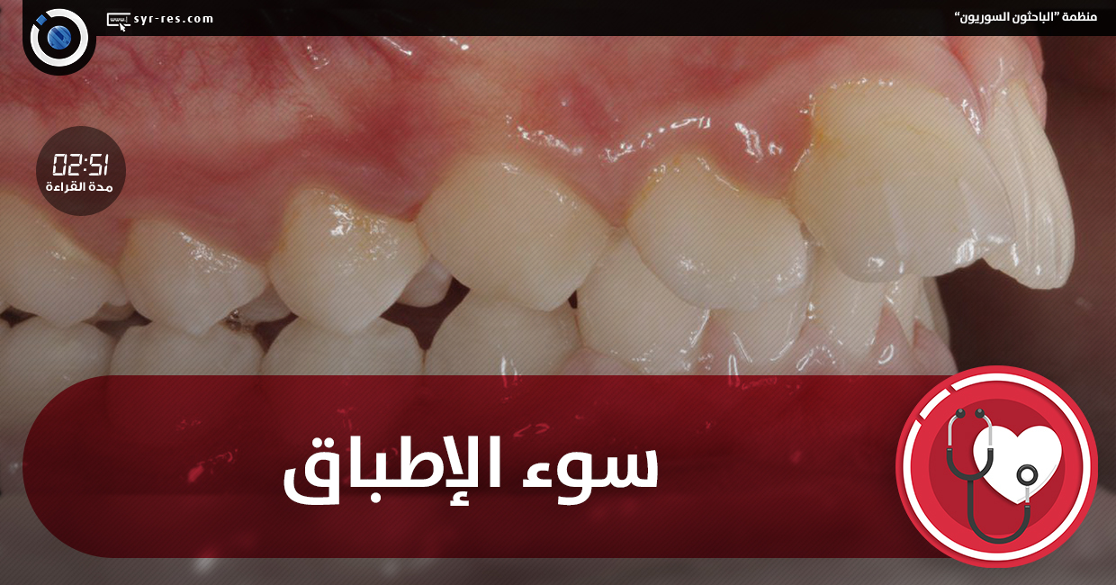 تقدم الاسنان العلوية